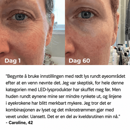 Iselle 7 - i - 1 LED Facial Sculptor - Iselle - Naturlig Hudpleie
